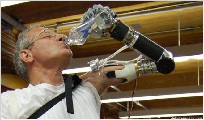 Картинки по запросу ПРОТЕЗ РУКИ