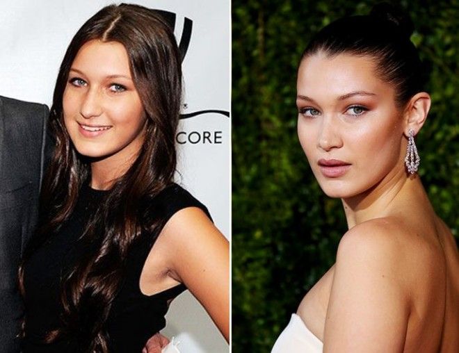 10 знаменитостей которым пластика явно пошла на пользу