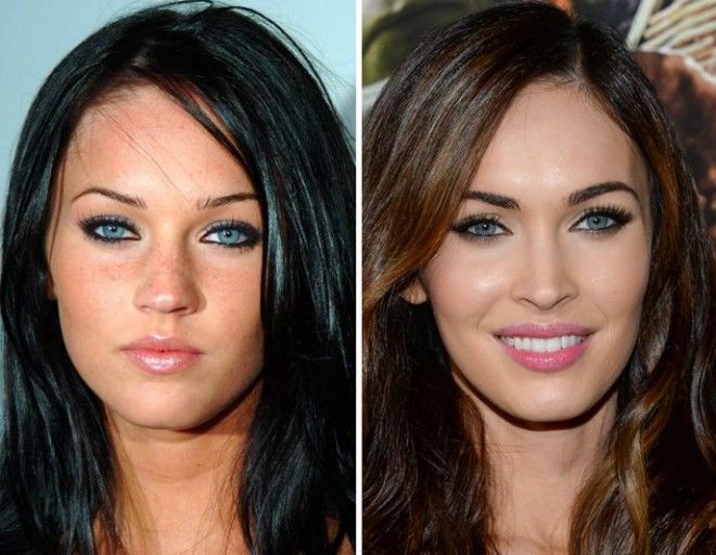 10 знаменитостей которым пластика явно пошла на пользу